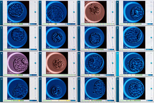 Advanced IVF laboratory technology displaying human embryo development stages on digital screen, fertility clinic incubator monitoring blastocyst growth, assisted reproductive in vitro fertilization