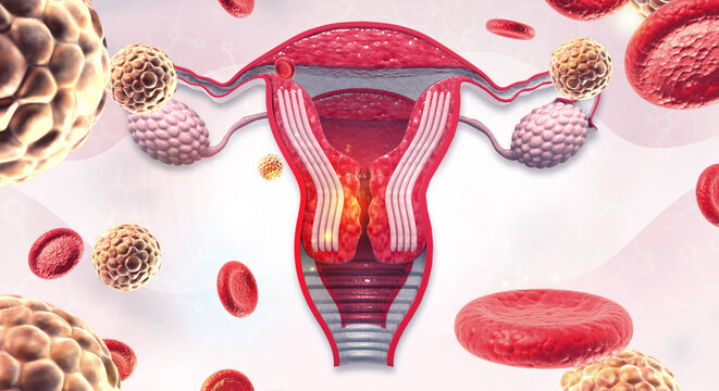  Detailed Illustration of a Female Uterus with Viral Infection, Inflammation, and Cellular Response. 3d illustration