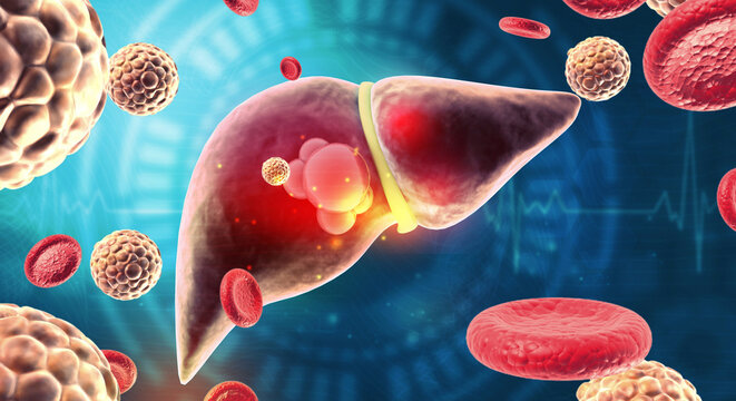 Detailed 3D Medical Illustration of a Human Liver Infected with Hepatitis Virus, Showing Blood Flow and Cellular Damage