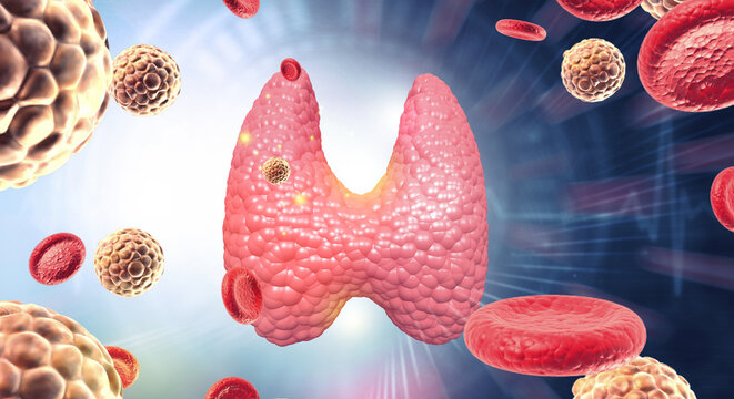 Human thyroid gland with an internal, microscopic view of a viral infection (thyroiditis). 