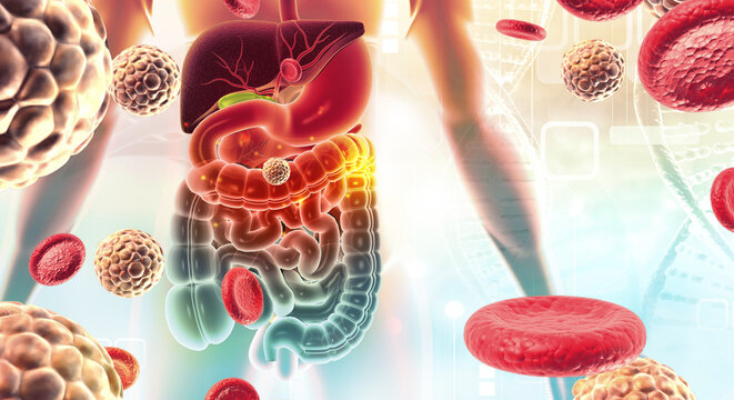 Detailed Illustration of the Human Digestive System Affected by a Viral Gastroenteritis. 3d illustration