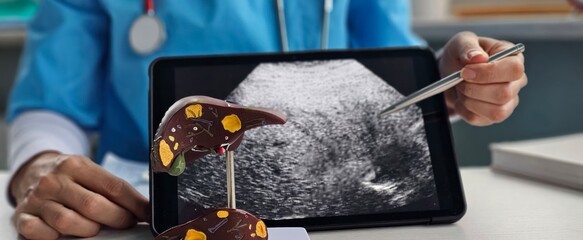 Medical professional examines liver model alongside ultrasound on tablet during patient consultation