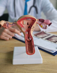 Educational model of female reproductive system in clinic setting
