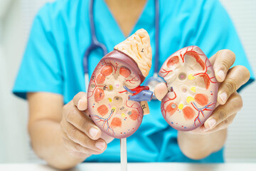 Chronic kidney disease, doctor with model for treatment urinary system, urology, Estimated glomerular filtration rate eGFR.