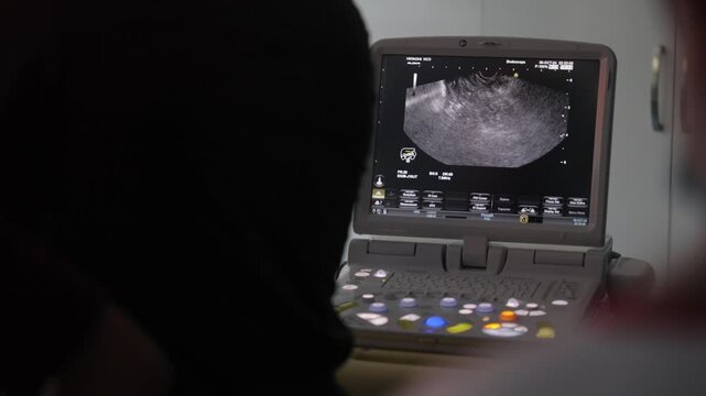 Close-up footage of a medical ultrasound machine screen showing a real-time scan. The monitor displays grayscale imaging. Ideal for use in healthcare, medical, and hospital-related content.