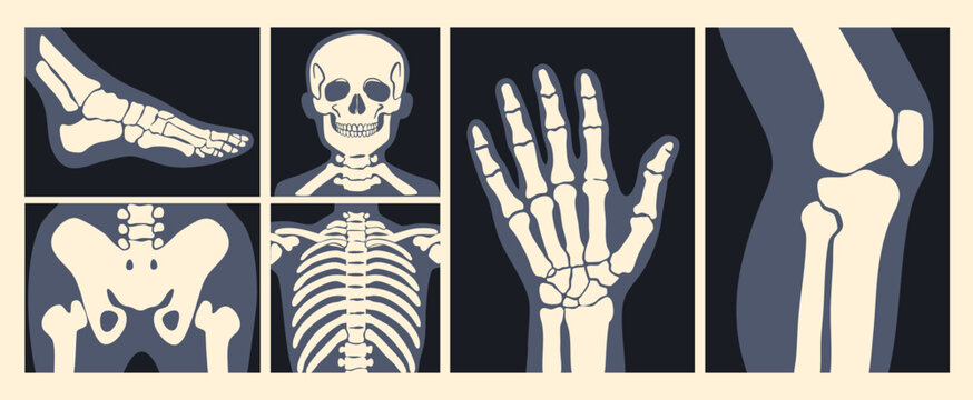 Various X Ray images. Human skeleton, foot, pelvis, arm, skull, chest, knee, ribs. Different body parts. Bone injury, medical scanning, checkup, hospital concept. Hand drawn Vector illustration 
