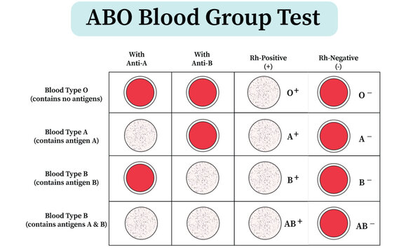 abo blood group test chart showing agglutination with anti-a anti-b and rh factor for blood type identification. Flat vector illustration isolated on white background