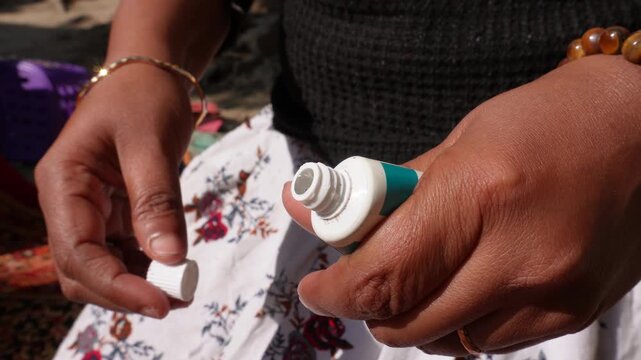 Patient squeezing ointment from aluminum tube onto finger