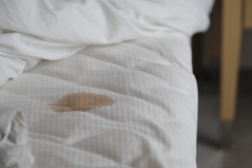 Obraz premium Stain on white bedding in a bedroom setting