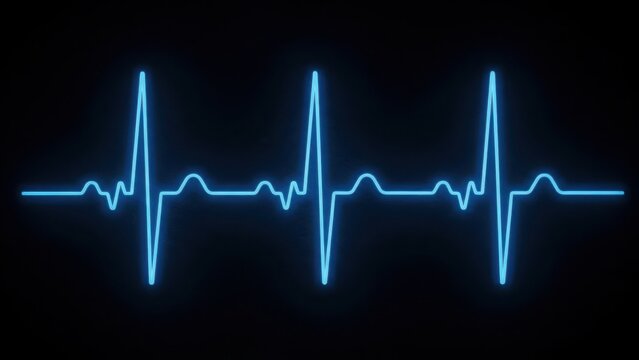 Electrocardiogram reading with normal sinus rhythm and healthy heartbeat pattern