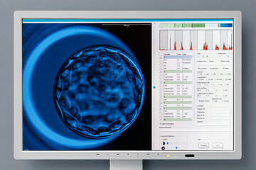 Advanced IVF laboratory technology displaying human embryo development stages on digital screen,...
