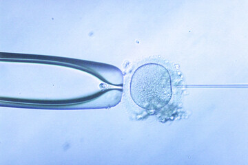 Intracytoplasmic Sperm Injection ICSI Procedure Under Microscope for IVF Infertility Treatment, Human Egg Fertilization Laboratory Technology for Assisted Reproduction and Artificial Insemination.