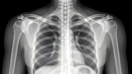 X-ray image of human chest and ribcage