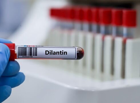 Blood sample tube for dilantin test analysis.