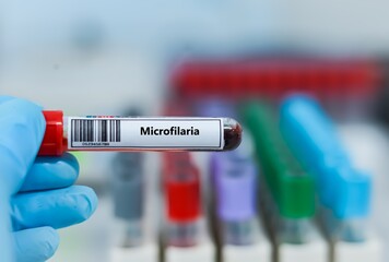 Fototapeta premium Blood sample tube for microfilaria test analysis.