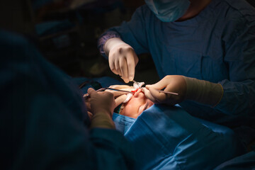 Close-up of a surgeon's hands in sterile gloves performing a precise rhinoplasty or nasal surgery...