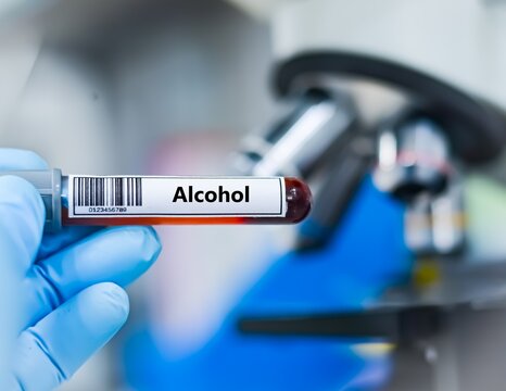 Blood sample tube for alcohol test analysis.