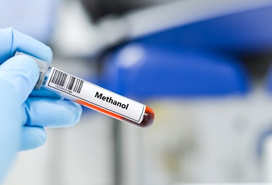 Blood sample tube for methanol test analysis.