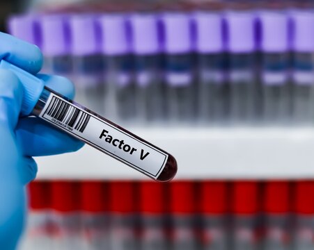 Blood sample tube for factor V test analysis.
