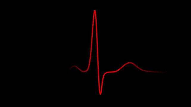 heart beat cardiogram on ecg illustration