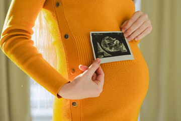 Prenatal ultrasound screening. Pregnant woman hands holding sonogram picture of unborn baby inside big belly. Happy expectant mom with fetus usi scan image. Young mother enjoying pregnancy. Maternity