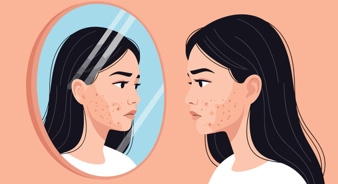 Young woman looks into a round mirror at her profile to examine acne and pimples on her cheek with a sad expression.