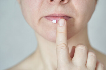 Close-up of caucasian female applying lip balm on chapped lips with index finger.