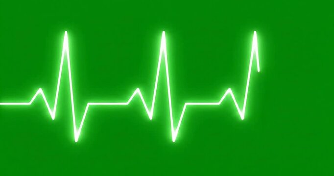 A realistic heartbeat pattern with green background and white lines moving in a continuous loop with ecg and electrocardiogram and medical and health and wellness