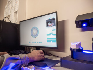 Dental 3D scanner capturing plaster model for digital impression and CAD CAM orthodontic treatment planning in modern dental technology lab.
