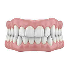 Obraz premium Dental bridge illustration isolated on transparent background