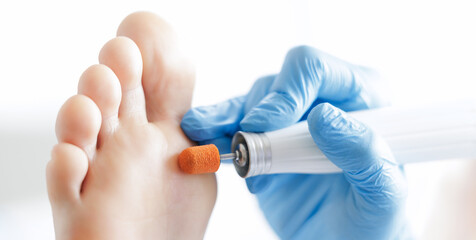 Obraz premium Podiatrist treating foot with precision, professional footcare in medical setting
