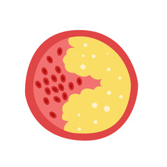 Cholesterol Buildup in Blood Vessel concept