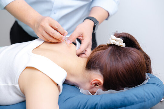 Professional Doctor Doing Acupuncture Therapy on Patient Back for Pain Relief.