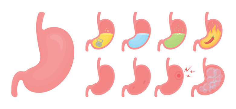 Set of human stomach with different health conditions: healthy, heaviness, bloating, ulcer, pain, high acidity, heartburn and stomach with water. Digestive system medical concept.