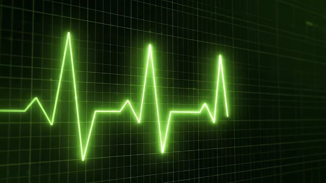 Electrocardiogram Heartbeat Monitoring in Medical Setting.