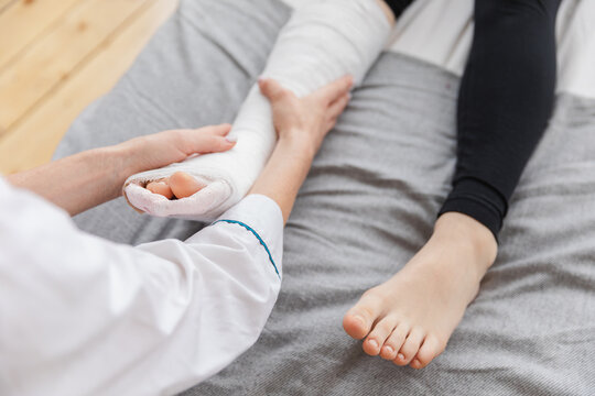 Girl with broken leg and doctor in clinic. Traumatologist orthopedist examines child leg in medical office. Doctor examining girl with medical plaster leg cast after broken ankle injury Rehabilitation