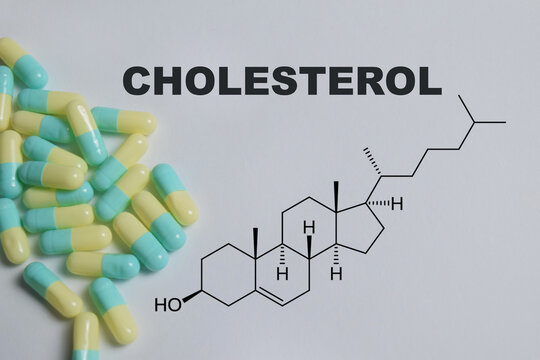 Concept of chemical structure cholesterol write on book isolated on Wooden Table.