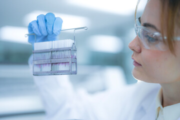 Focused female scientist holding a rack of glass slides for microscopic analysis in a sterile clinical laboratory. Professional medical researcher examining tissue samples for diagnosis.