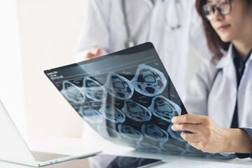 Asian orthopedics surgeon doctor team examining patient's knee joint x-ray films, MRI bone scan, ct scan at radiology orthopedic unit in hospital. knee joint film x ray, staff conference