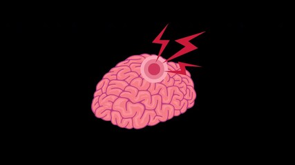 Severe Headache and Brain Pain Medical Concept with Lightning Illustration