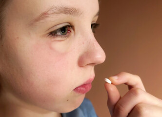 Close-up of a child holding a pill near the mouth, showing visible allergy symptoms under the eye and irritation on the face