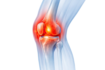 Human knee joint anatomy showing femur tibia patella cartilage and ligaments with highlighted inflammation and pain isolated on white background