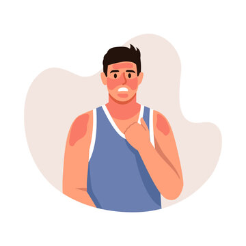 Vector illustration of a confused man with a sunburn. Cartoon scene of a dark-haired handsome man dressed in a T-shirt, with red spots on his skin, sunburned skin isolated on a white background.