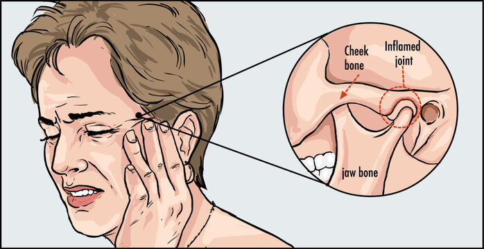 TMD TMJ disorder stock illustration