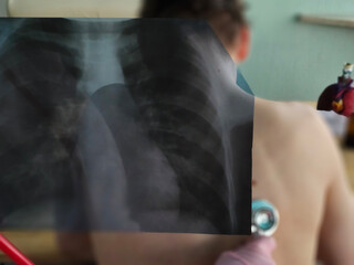 Doctor examines patient with stethoscope while looking at chest X-ray