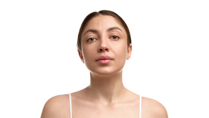 Front view female portrait with natural skin and direct gaze. Concept of dermatology research, cosmetic assessment, aesthetic clinics promo, and realistic representation in advertising media.