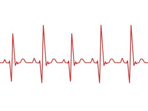 Regular heart rhythm graph