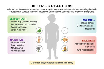 Allergic reactions in kids, medical flashcard illustration
