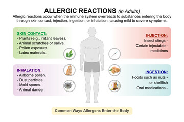 Allergic reactions in adults flashcard