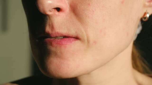 Profile of stressed woman showing skin imperfections, Portrait capturing emotional tension and visible skin features of woman, Interior scene depicting woman with anxious expression and detailed skin
